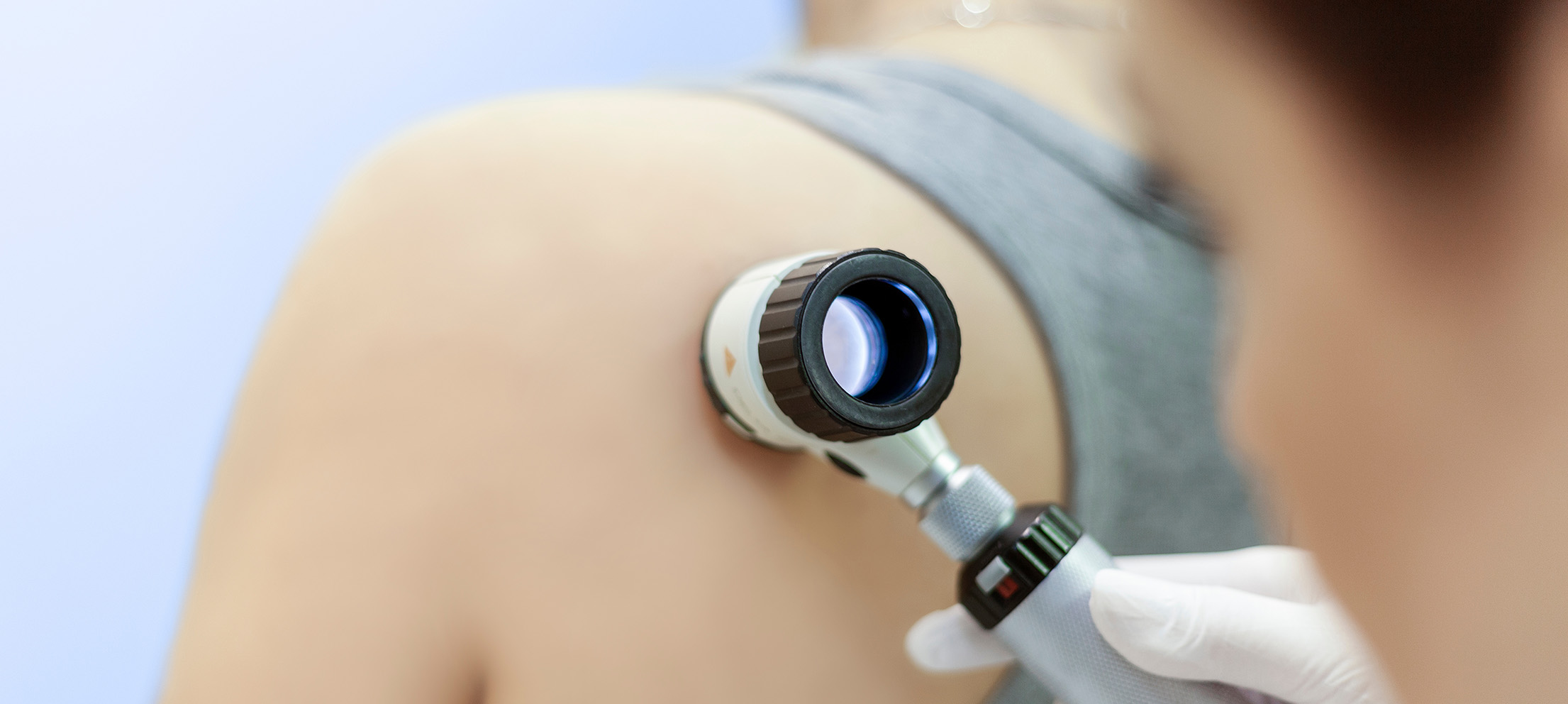 Skin cancer check 