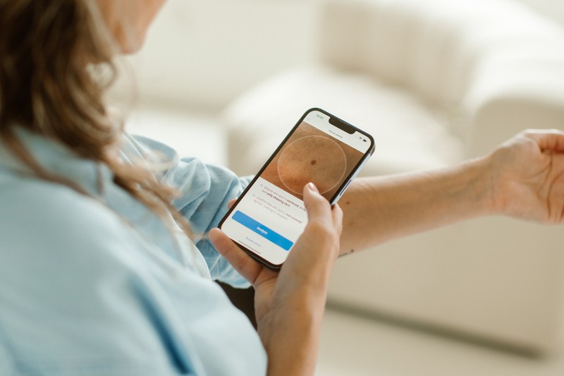 Woman using SkinVision App to scan mole